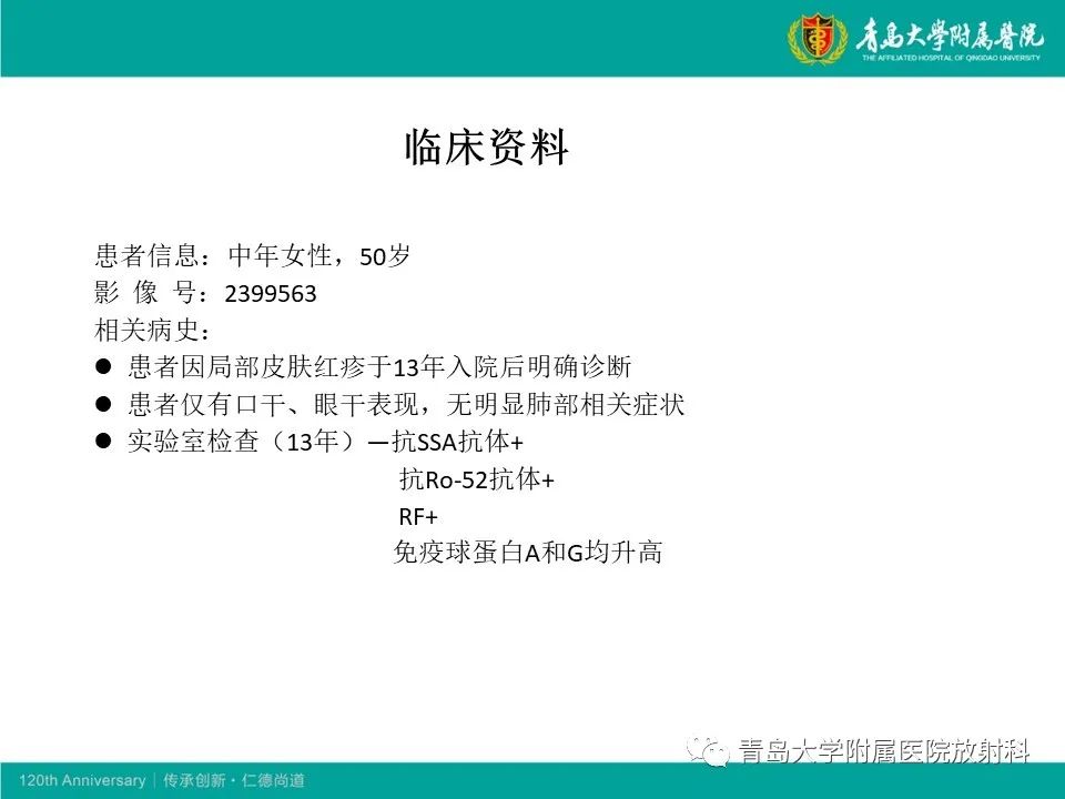 【病例】原发性干燥综合征继发肺淀粉样变性1例CT影像-2