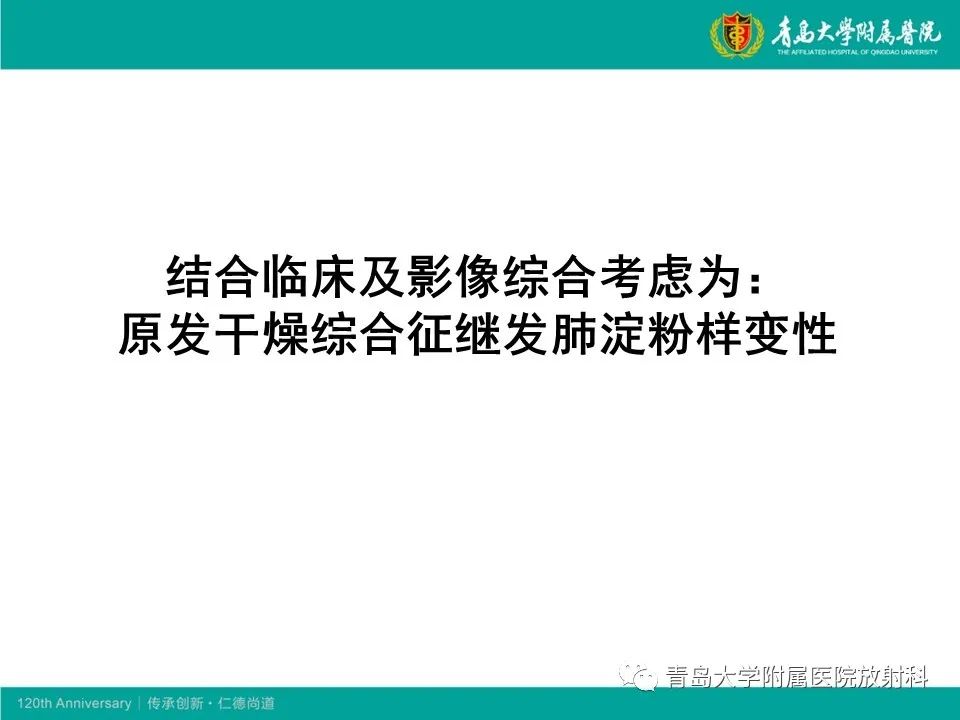 【病例】原发性干燥综合征继发肺淀粉样变性1例CT影像-15