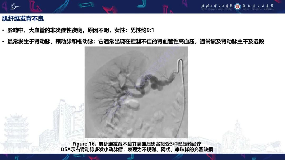 【PPT】肾动脉：解剖、病理及血管内治疗-19