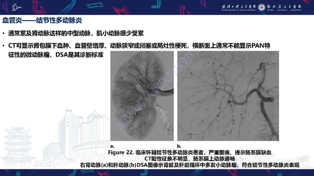【PPT】肾动脉：解剖、病理及血管内治疗-24