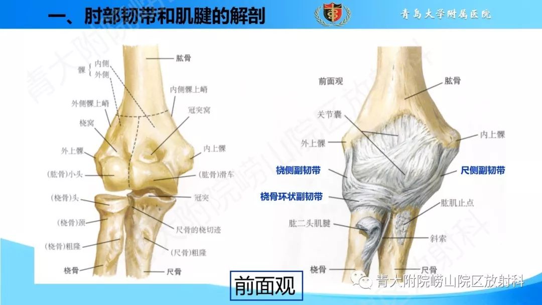 【PPT】肘部韧带和肌腱损伤的MRI诊断-5