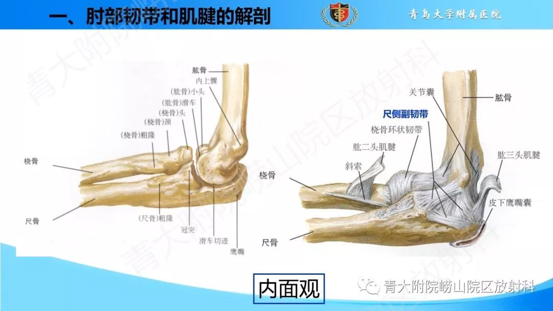 【PPT】肘部韧带和肌腱损伤的MRI诊断-6