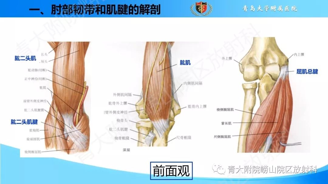 【PPT】肘部韧带和肌腱损伤的MRI诊断-8