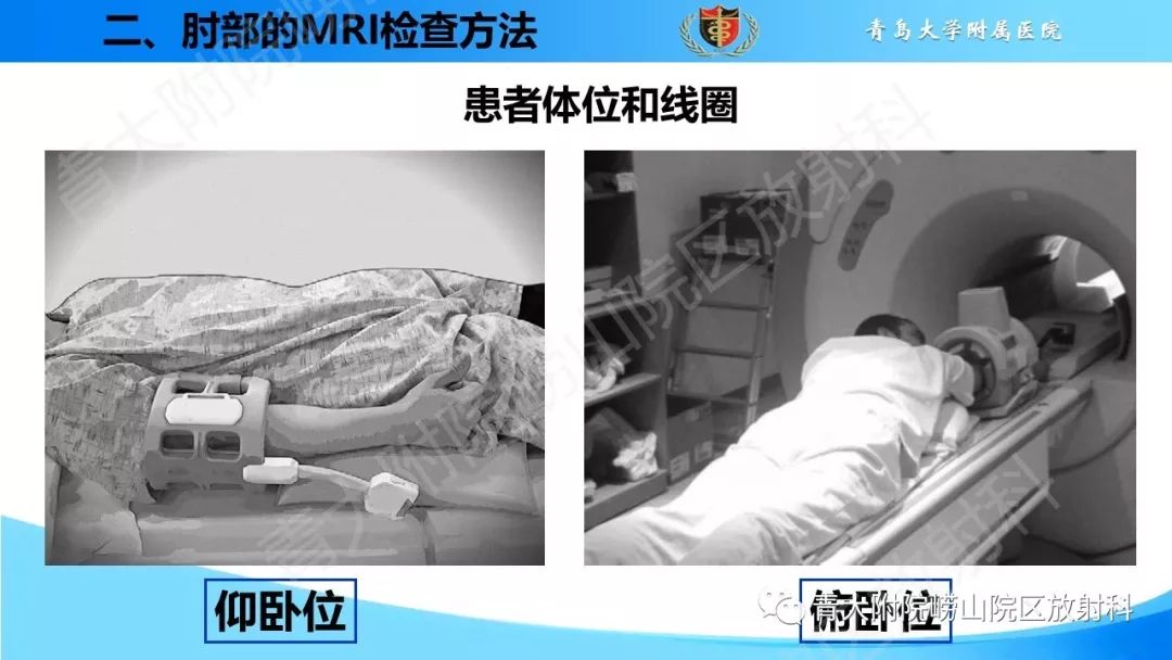 【PPT】肘部韧带和肌腱损伤的MRI诊断-10