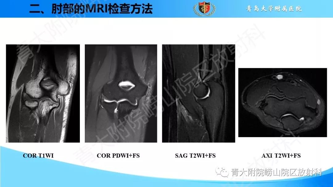 【PPT】肘部韧带和肌腱损伤的MRI诊断-12