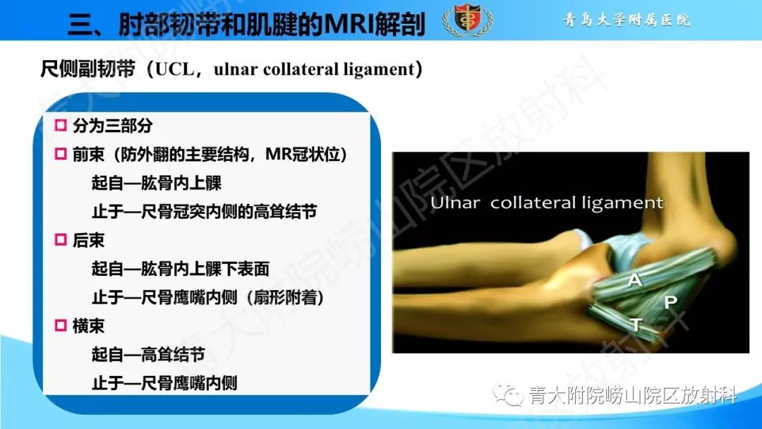 【PPT】肘部韧带和肌腱损伤的MRI诊断-13