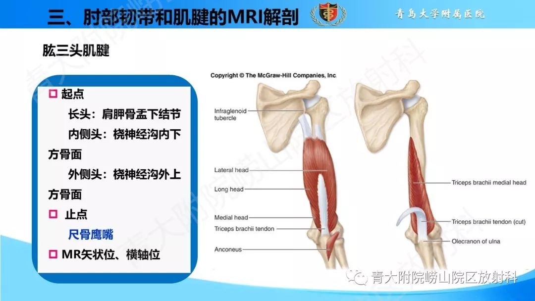 【PPT】肘部韧带和肌腱损伤的MRI诊断-25