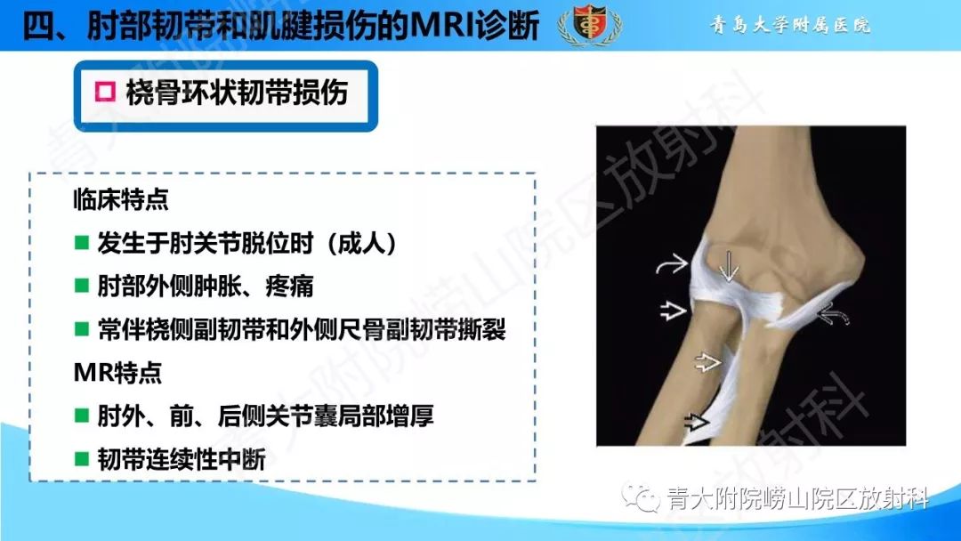 【PPT】肘部韧带和肌腱损伤的MRI诊断-34