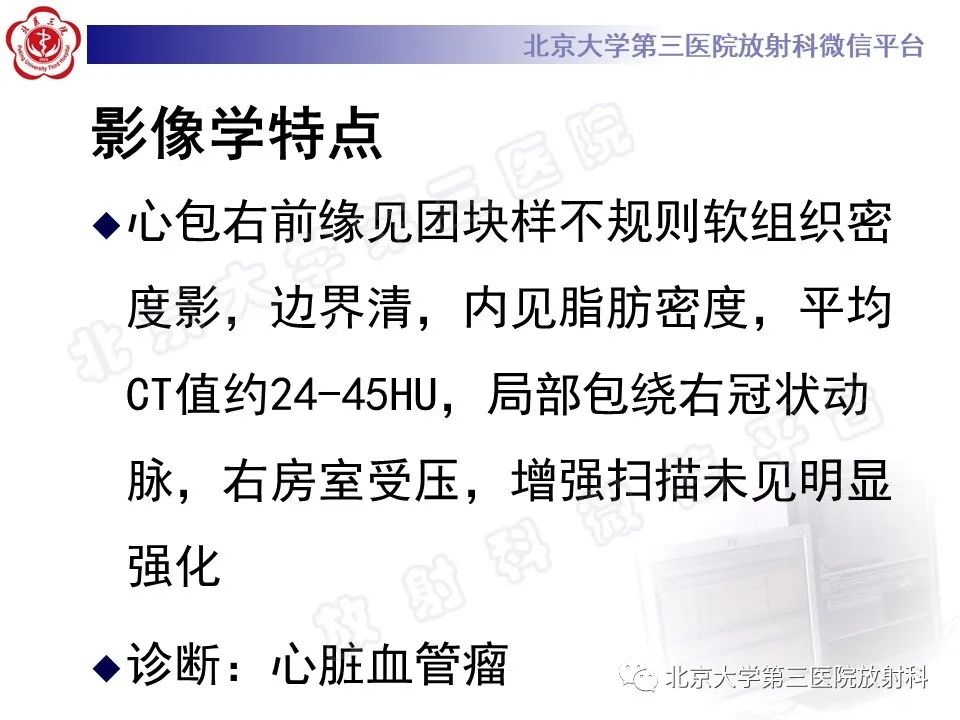 【PPT】心脏血管瘤-5