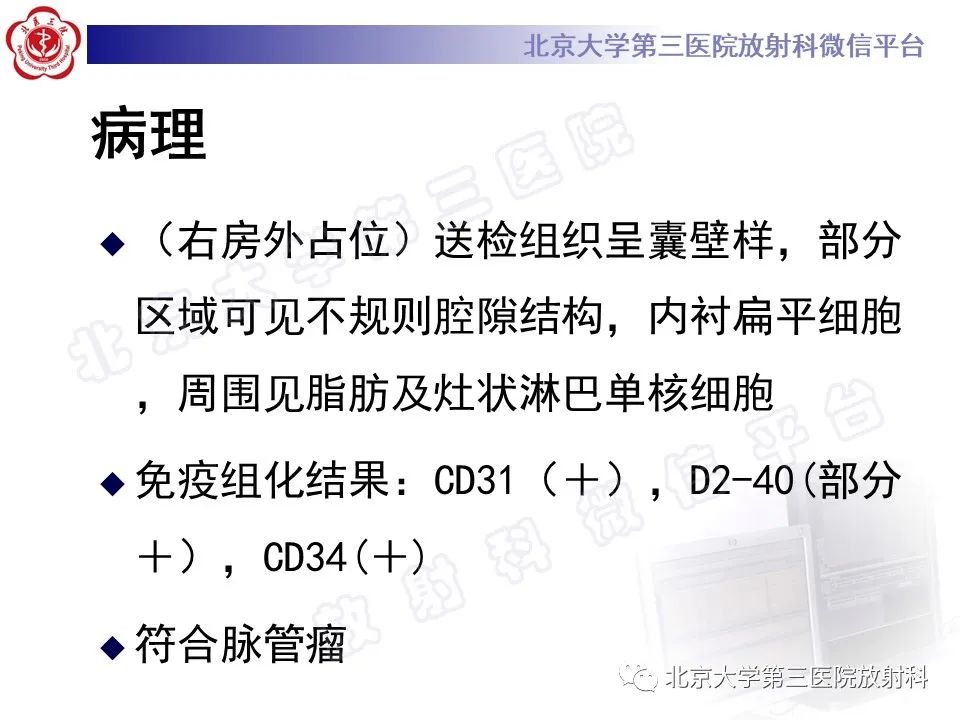 【PPT】心脏血管瘤-6