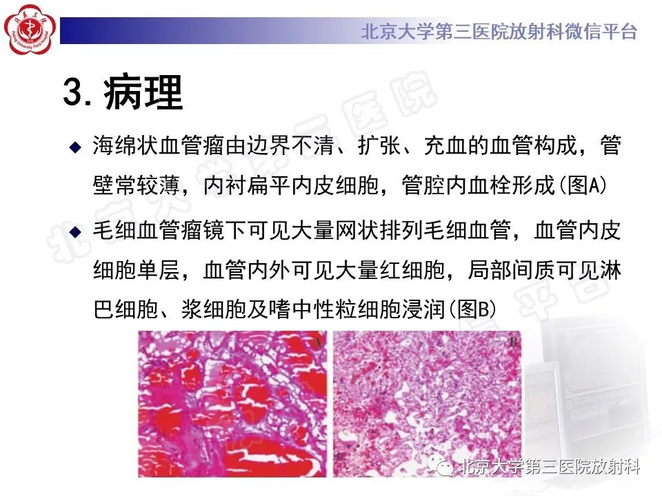 【PPT】心脏血管瘤-10