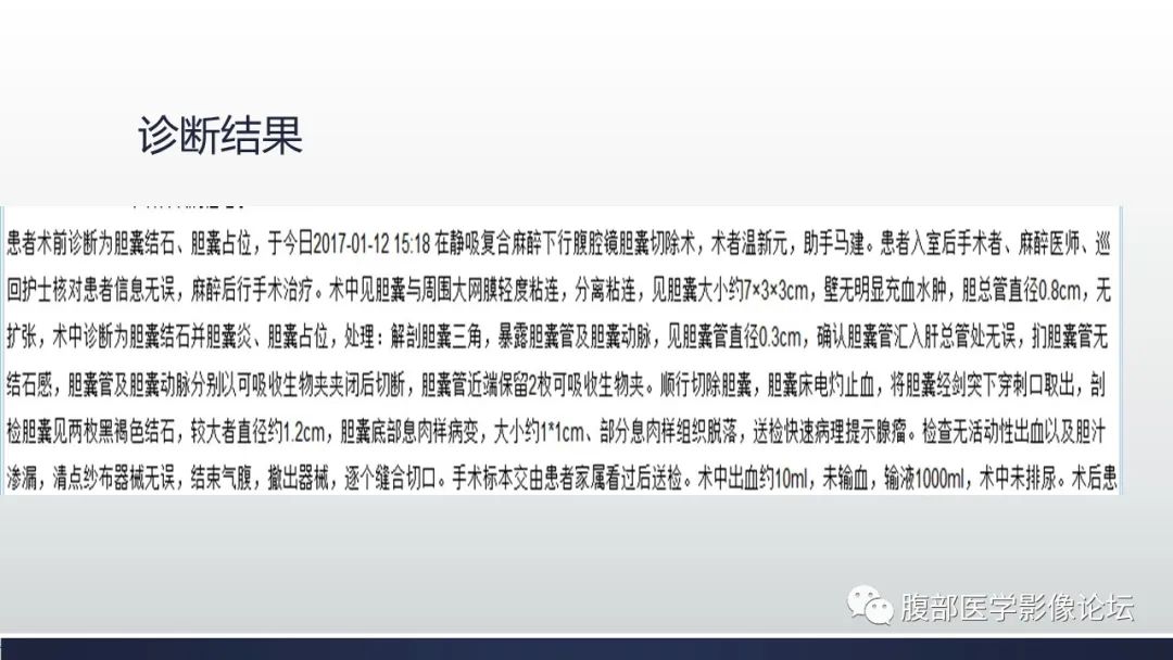 【病例】胆囊管状腺瘤1例CT及MR影像表现-8