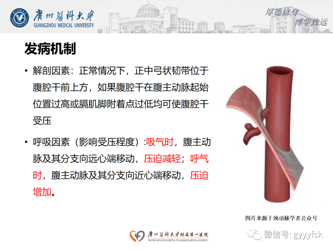 【病例】正中弓状韧带压迫综合征1例CT影像-9