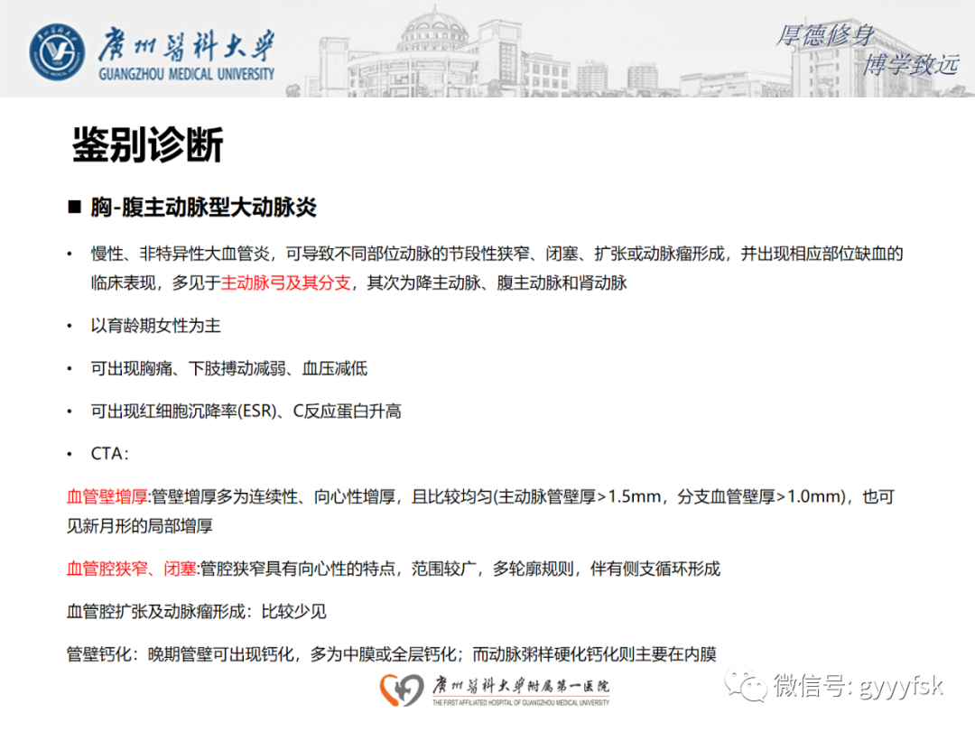 【病例】正中弓状韧带压迫综合征1例CT影像-16