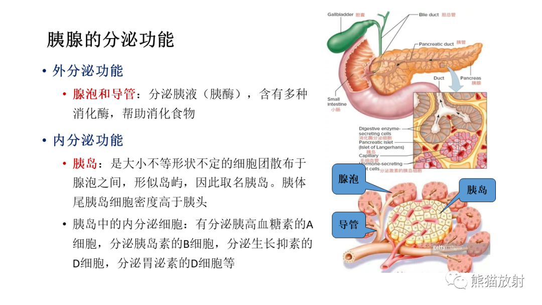 【病例】胰腺神经内分泌肿瘤2例CT及MR影像-18
