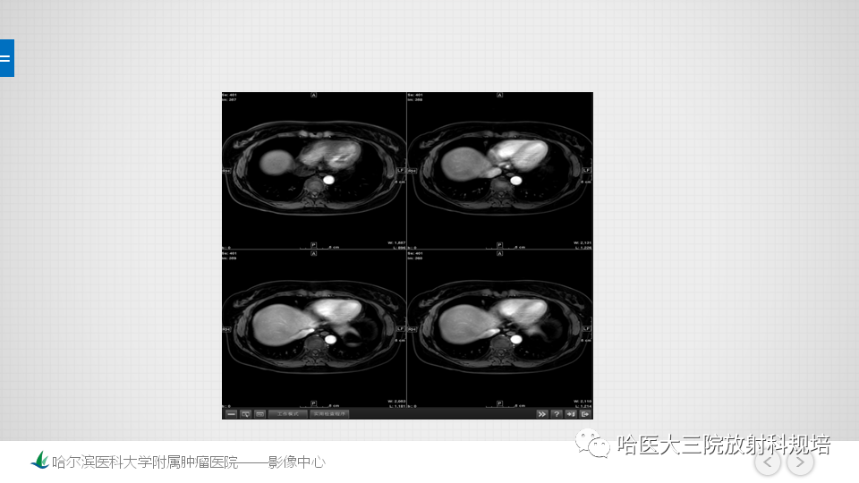 【PPT】肝脏扫描规范及常见问题-10