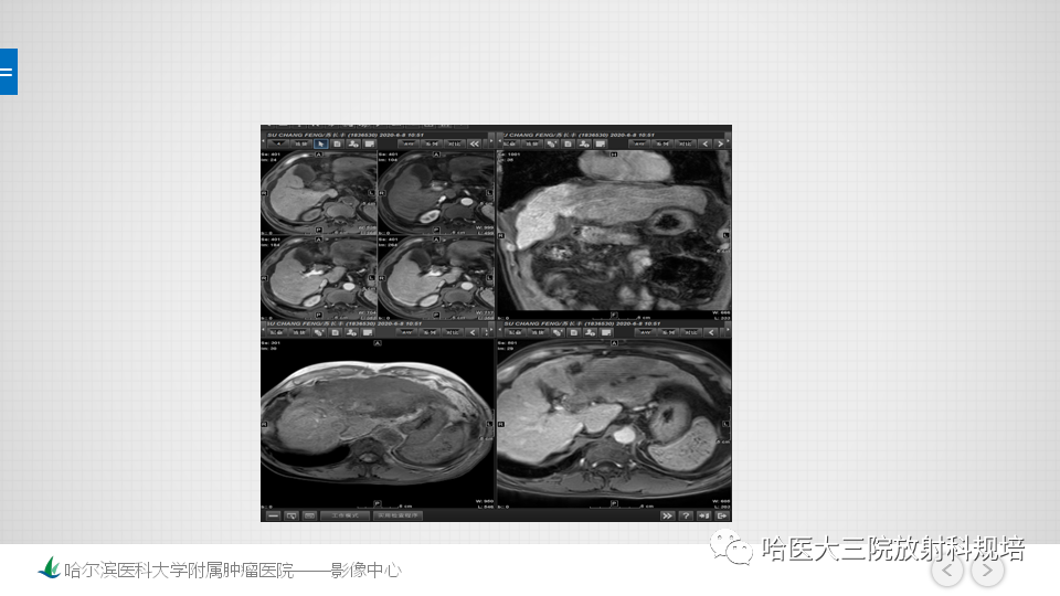【PPT】肝脏扫描规范及常见问题-19
