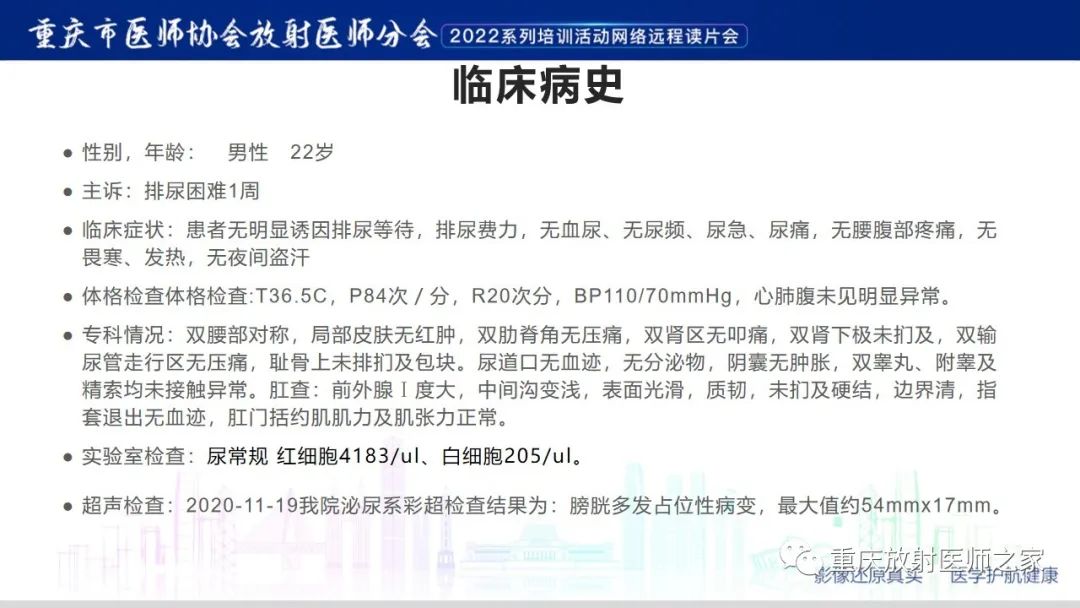 【病例】腺性膀胱炎1例CT影像-2
