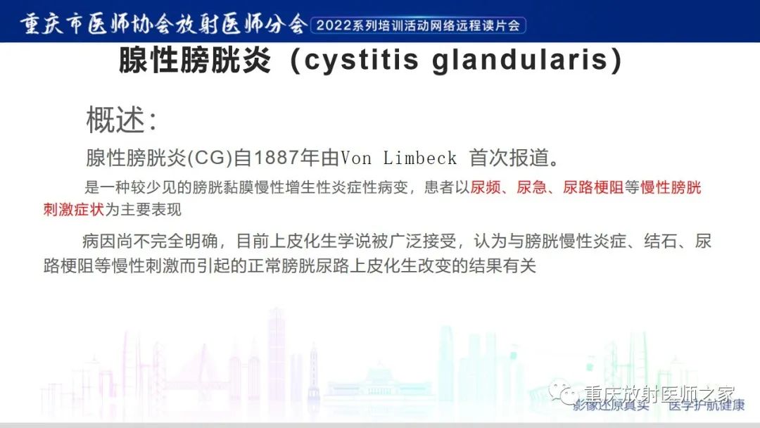 【病例】腺性膀胱炎1例CT影像-10