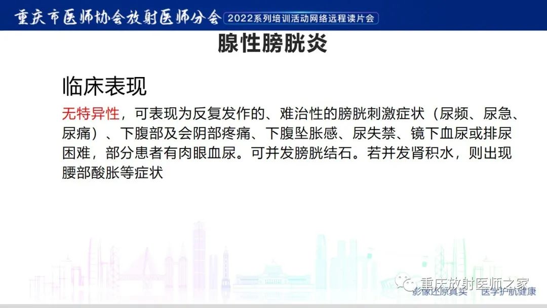 【病例】腺性膀胱炎1例CT影像-14