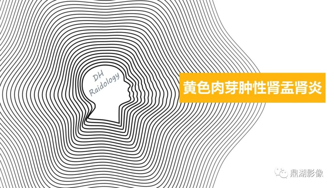 【PPT】黄色肉芽肿性肾盂肾炎-1