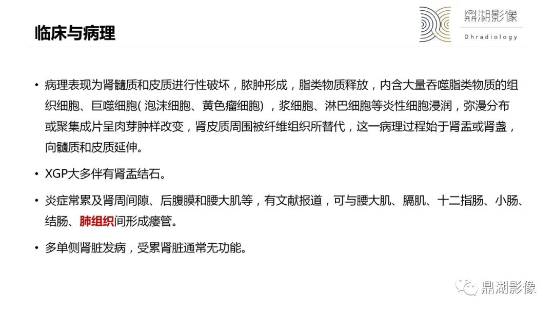 【PPT】黄色肉芽肿性肾盂肾炎-11