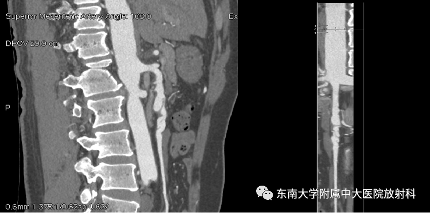 【PPT】肌纤维发育不良-2