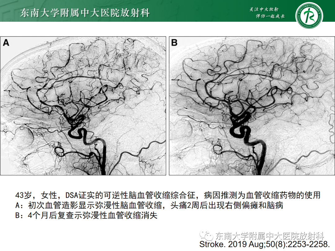 【PPT】肌纤维发育不良-18