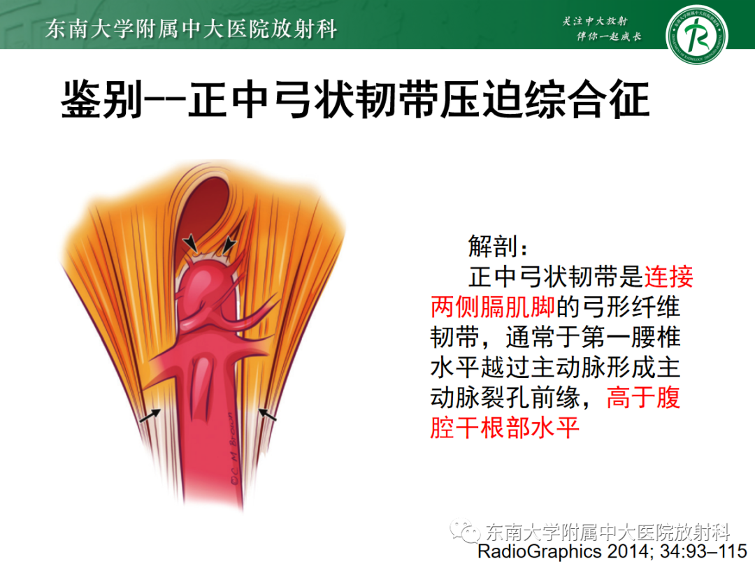 【PPT】肌纤维发育不良-19