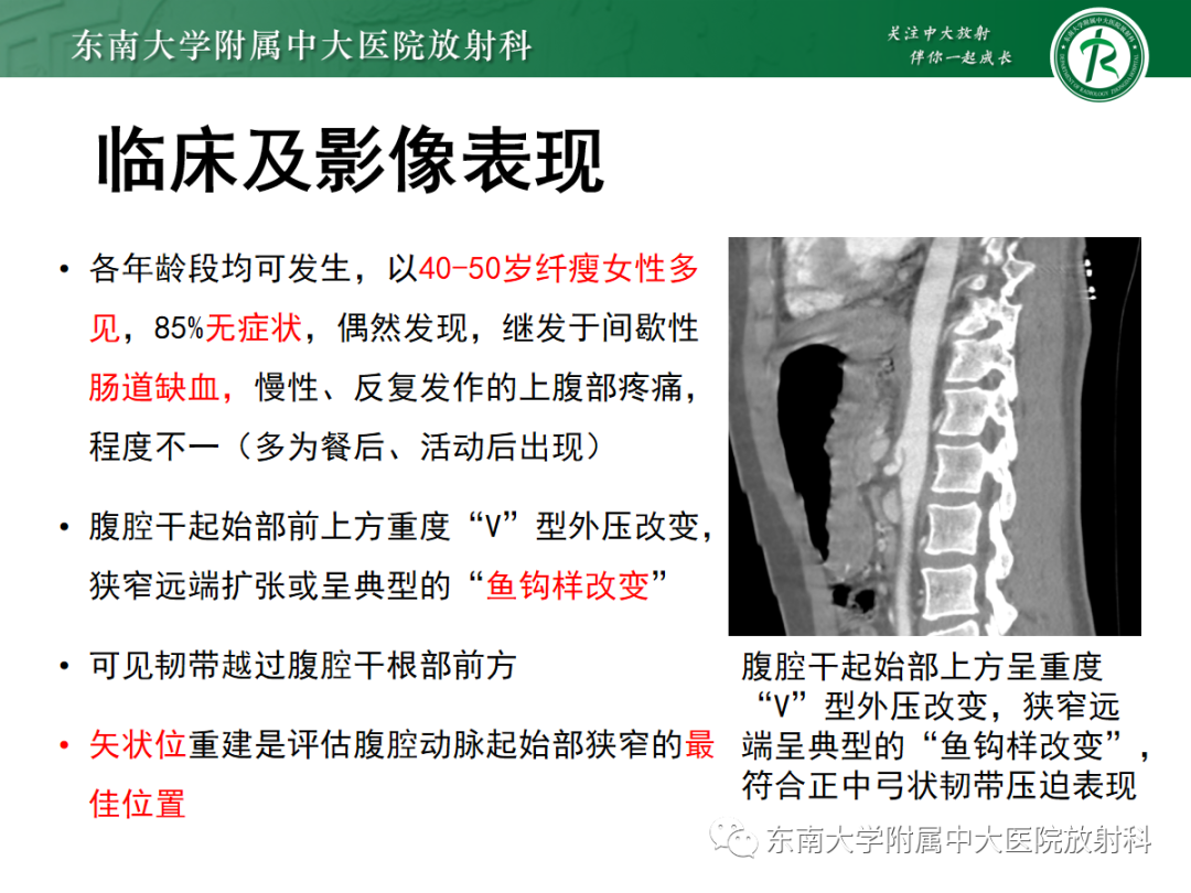 【PPT】肌纤维发育不良-21