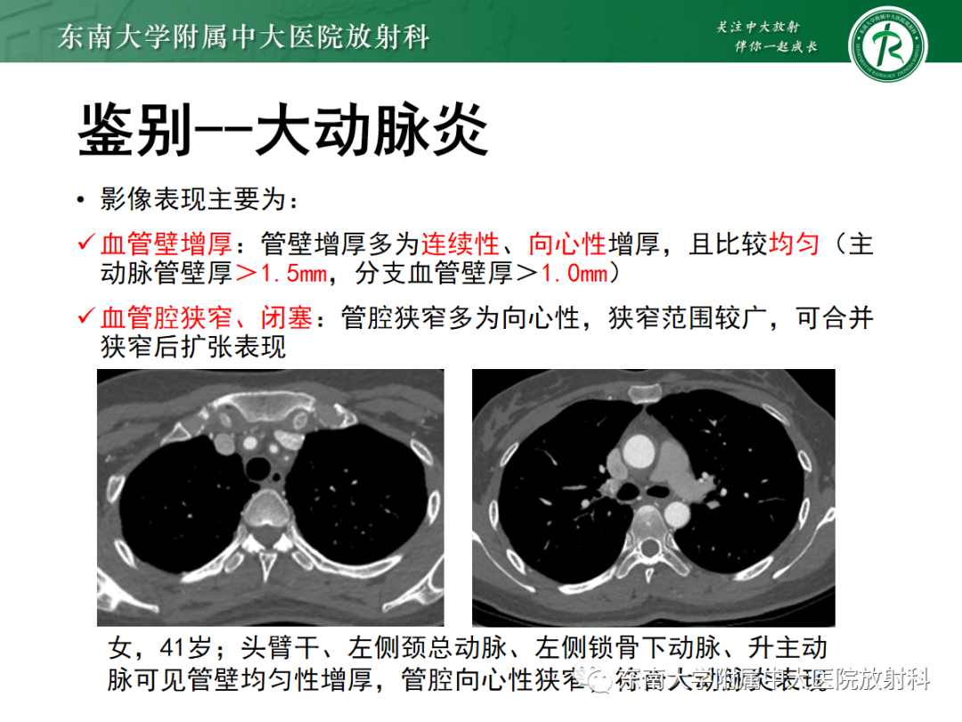 【PPT】肌纤维发育不良-23