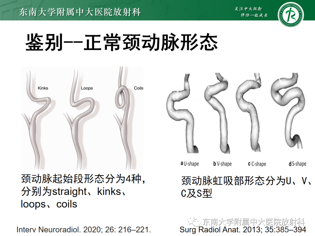 【PPT】肌纤维发育不良-25