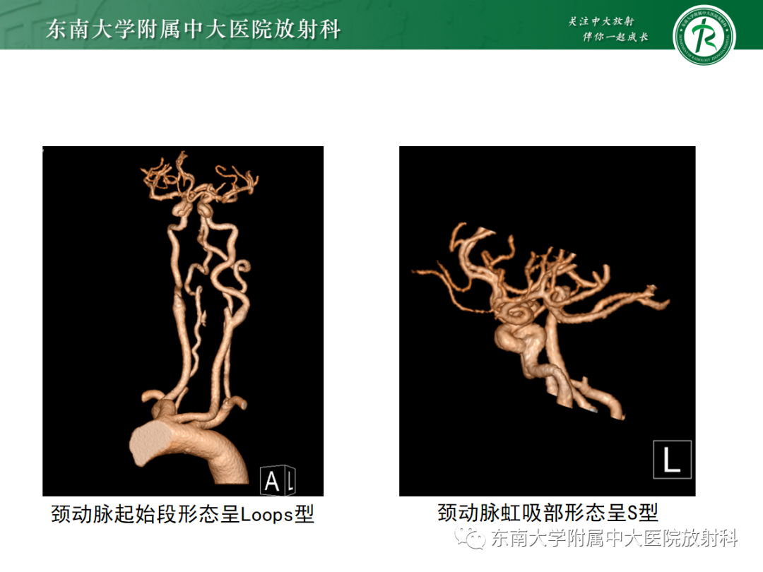 【PPT】肌纤维发育不良-26