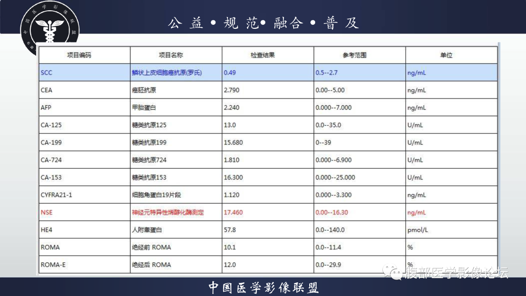 【病例】腹膜后边缘区淋巴瘤1例CT影像-3