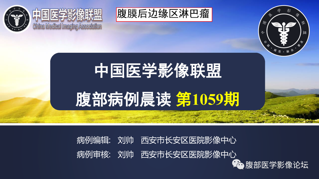 【病例】腹膜后边缘区淋巴瘤1例CT影像-1
