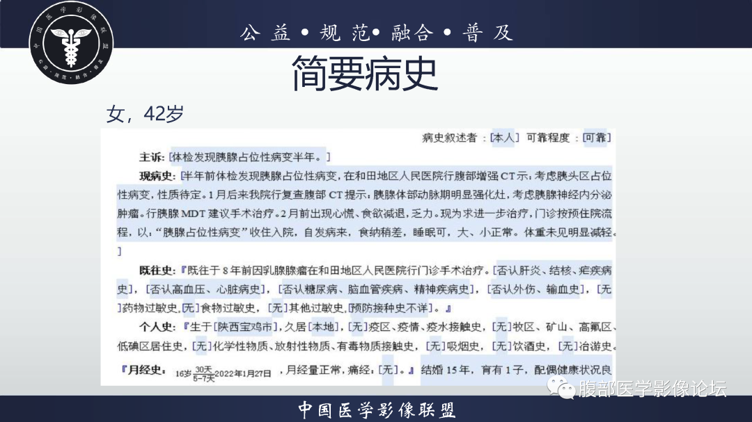 【病例】腹膜后边缘区淋巴瘤1例CT影像-2