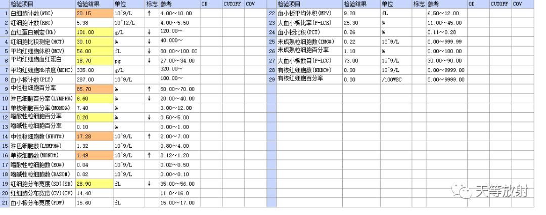 【病例】肝脓肿1例CT影像-15
