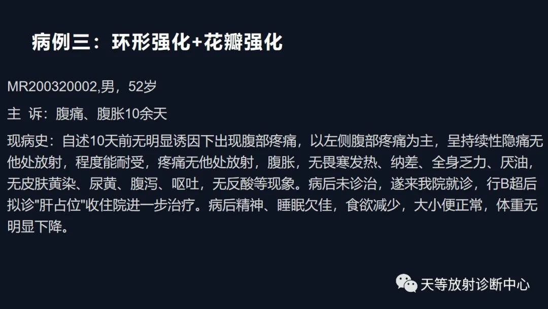 【病例】肝脓肿1例CT影像-30