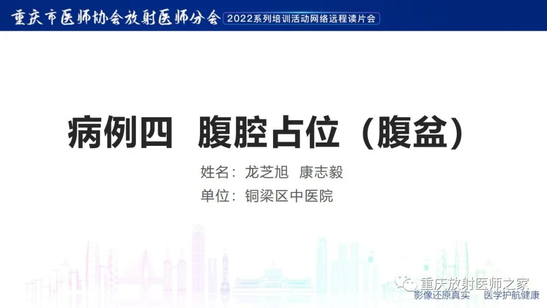 【病例】腹腔纱布异物(纱布瘤)一例CT影像-1