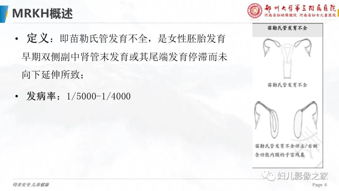 【病例】先天性阴道闭锁1例MR影像-17