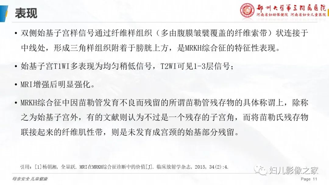 【病例】先天性阴道闭锁1例MR影像-22