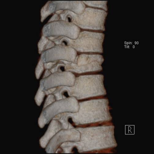 38种特殊类型的骨折
