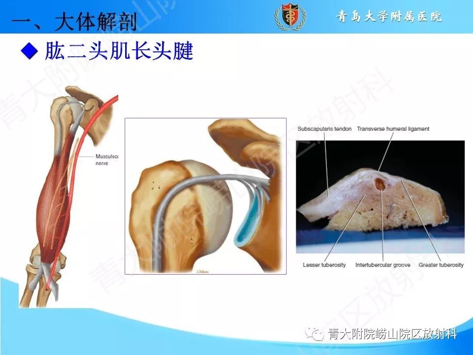 【PPT】肩关节运动损伤的MRI诊断