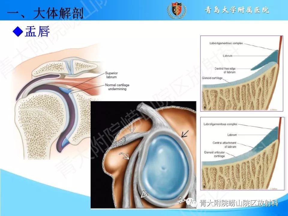 【PPT】肩关节运动损伤的MRI诊断