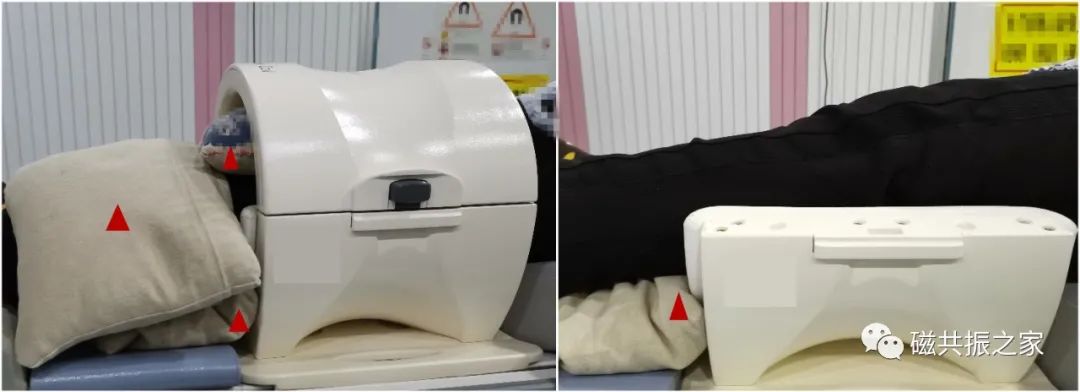 膝关节MRI扫描中的一系列问题-5