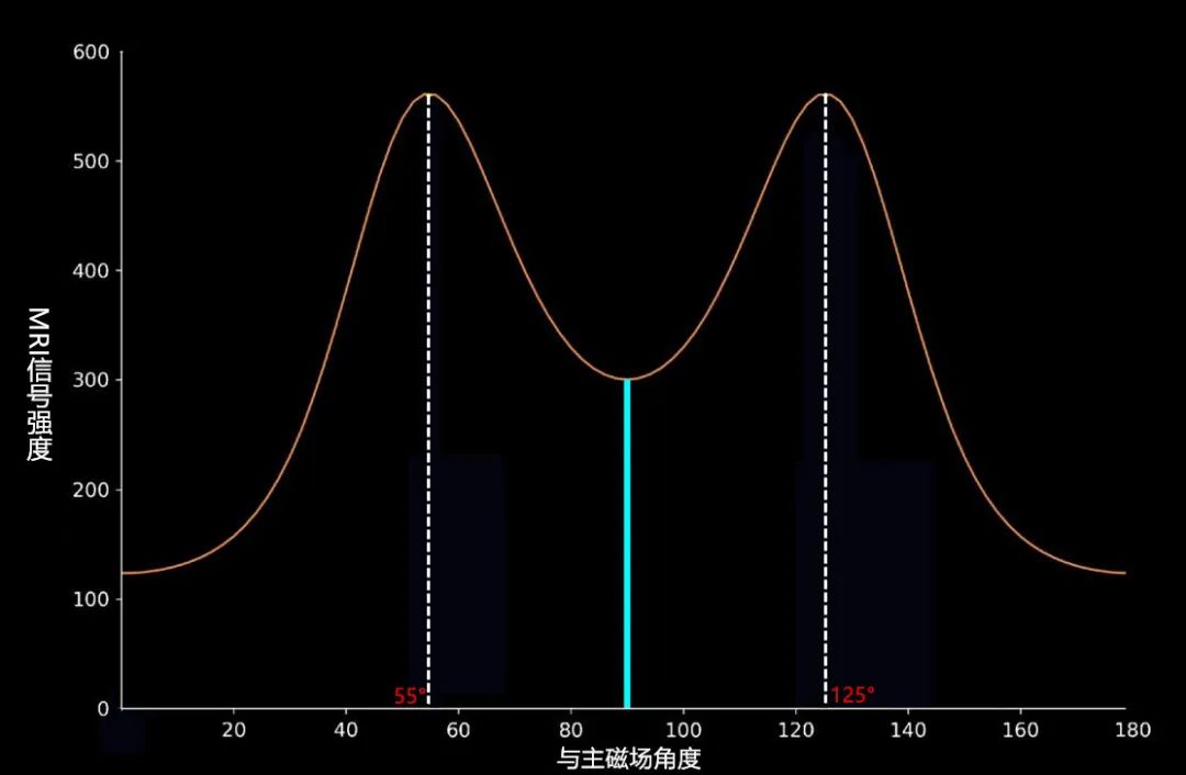 临床扫描中遇到魔角效应该怎么办？-3