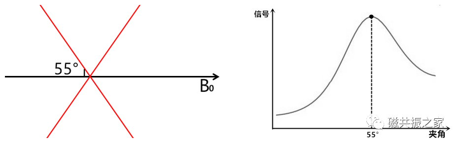 临床扫描中遇到魔角效应该怎么办？-2
