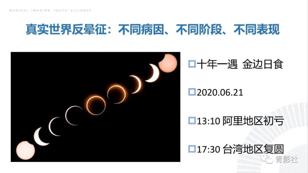 【PPT】肺部反晕征影像诊断思维-4