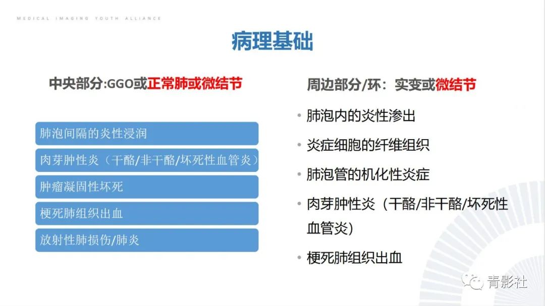【PPT】肺部反晕征影像诊断思维-8