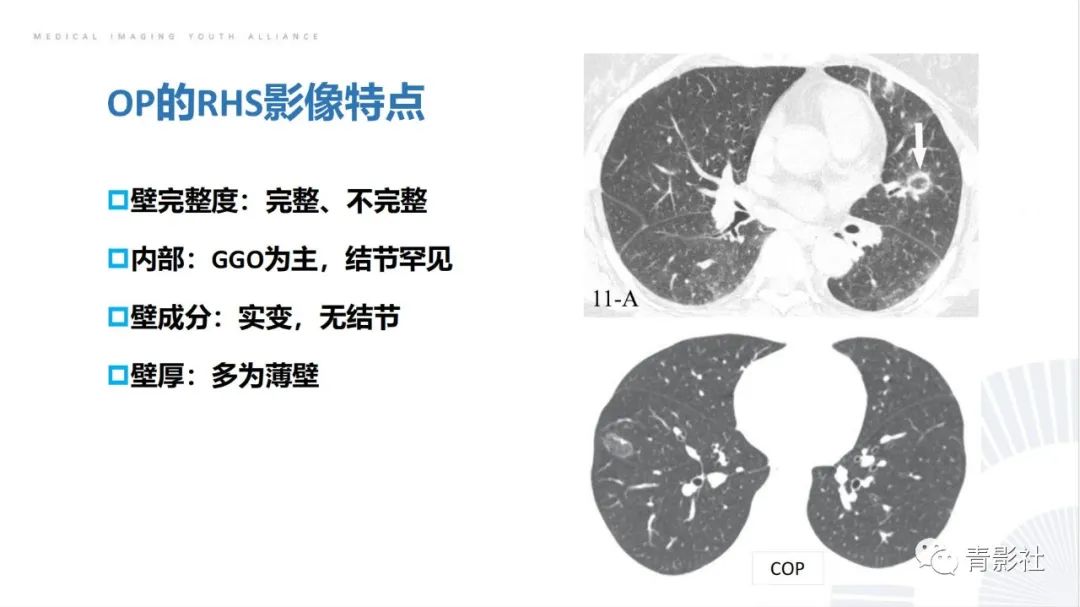 【PPT】肺部反晕征影像诊断思维-16